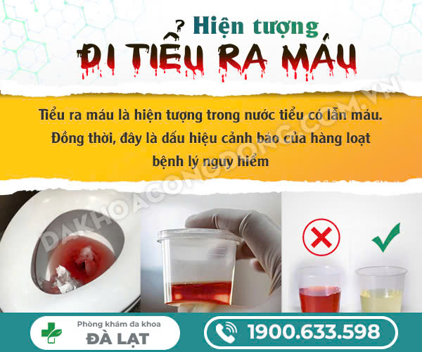 Hình ảnh minh họa